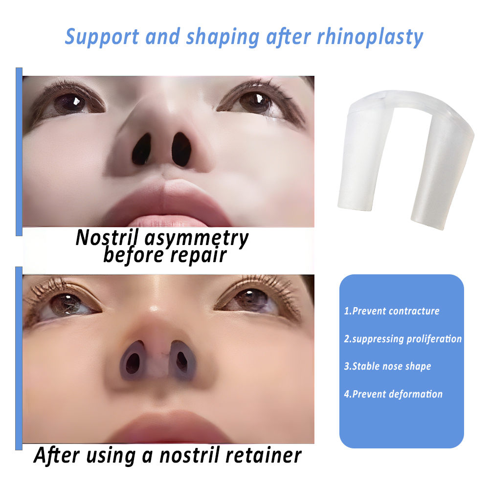 Fixateur de narines pour la ré - Anti Snore Contour Pillow avis et prix
