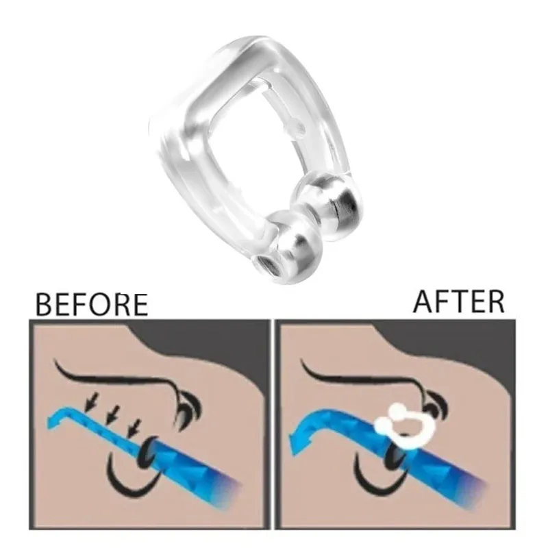 1/2/3/4/5/6 Pcs Dispositif Ant - Anti Snore Contour Pillow avis et prix