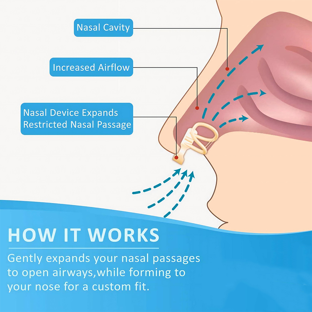 Dilatateur Nasal Anti-ronfleme - Anti Snore Contour Pillow avis et prix