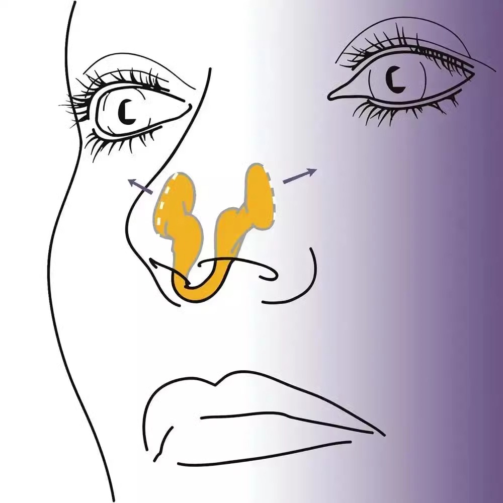 Dispositif Anti-ronflement en  - Anti Snore Contour Pillow avis et prix
